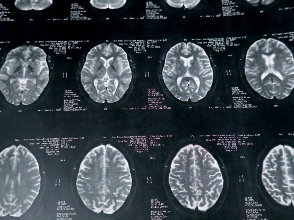 Human Brain Has Five ‘Eras’, With Full Adult Phase Not Beginning Until Early 30s, Study Finds